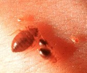 Bed Bugs